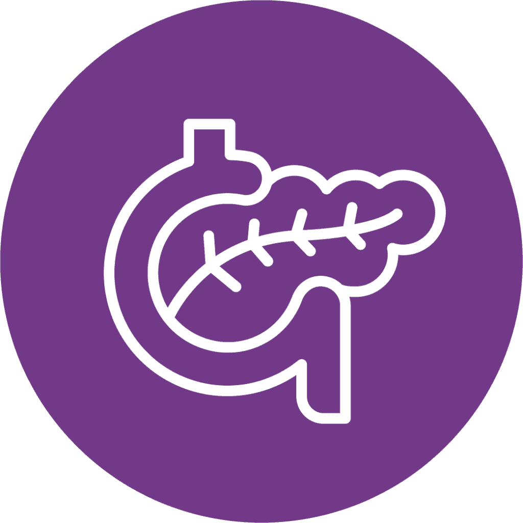 Research Finds Viable Marker for the Early Diagnosis of a Particular Type of Pancreatic Cancer